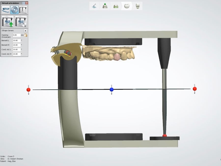 Proper Use Of The 3shape Virtual Articulator With Posterior Crowns On